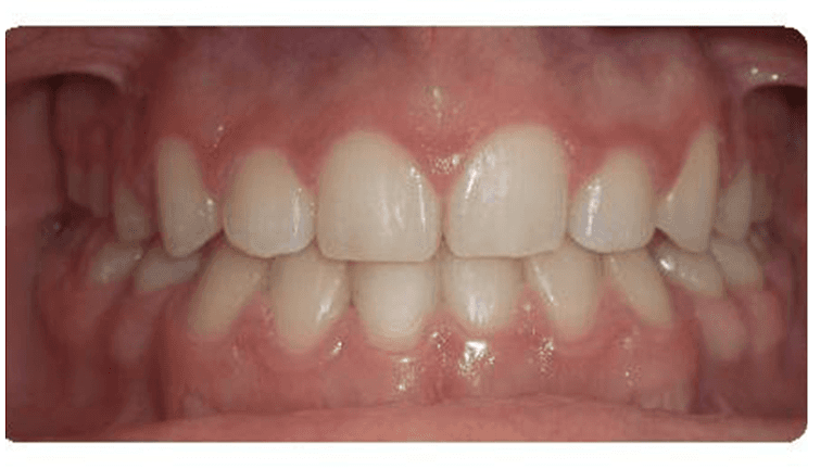 Case-2-After-Image