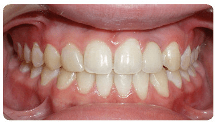 Case-3-After-Image