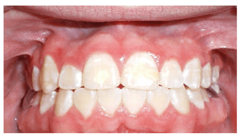 Case-4-After-Image