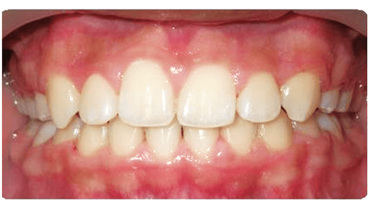 Case-9-After-Image