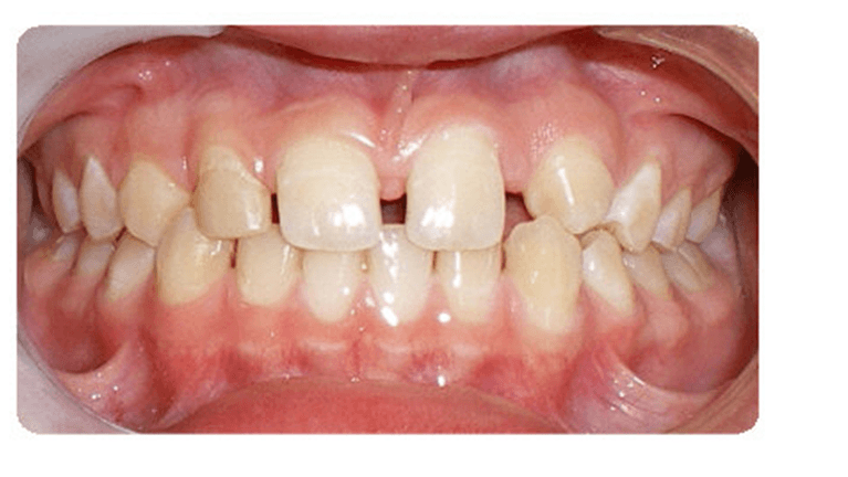 Case-3-Before-Image