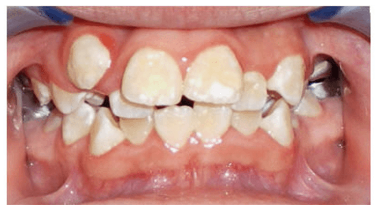 Case-4-Before-Image