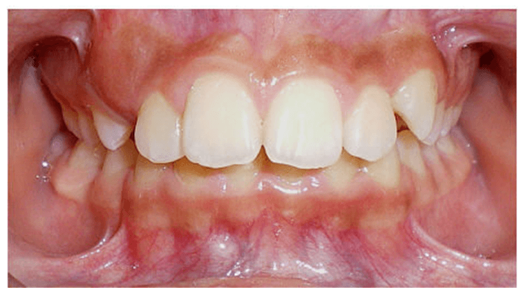 Case-9-Before-Image