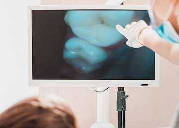 spring branch dentist | intraoral cameras